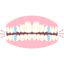 TMJ and Teeth Grinding