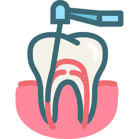 Root Canal Treatment