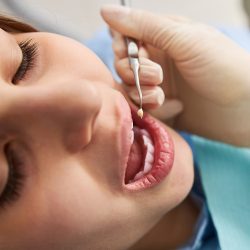 Dental Fillings-2
