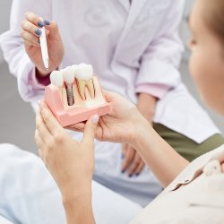 Dental Implants