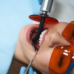 Root Canal-2
